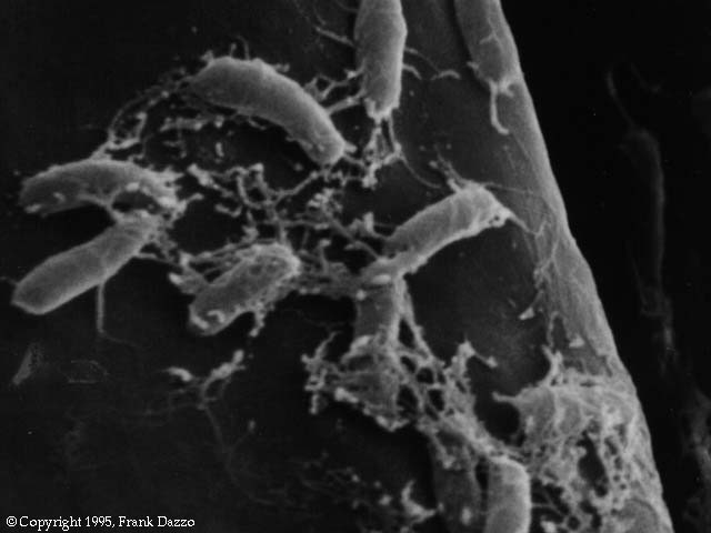 Rhizobium on clover root hair