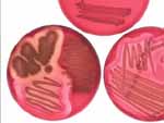 bloodplates