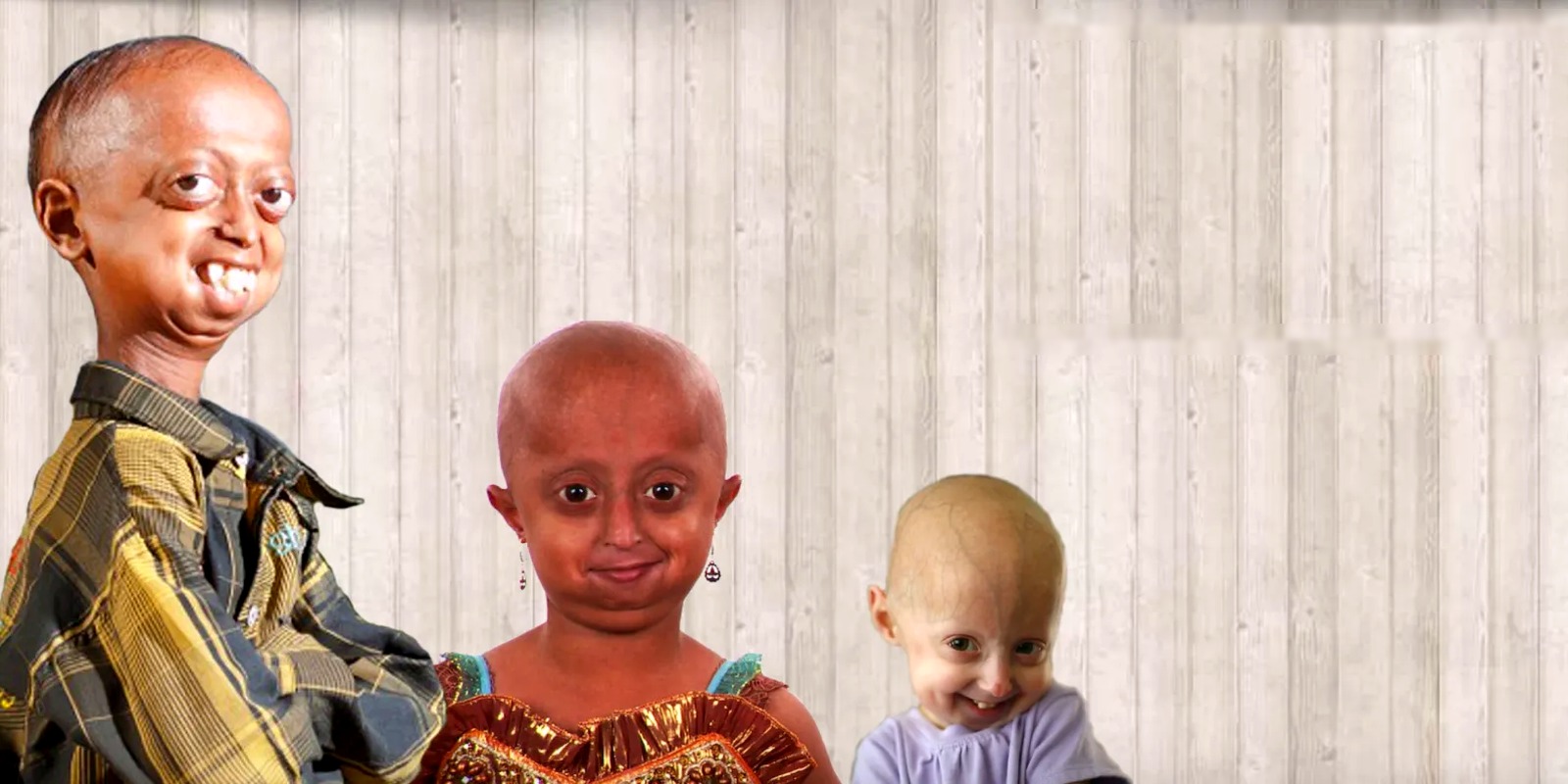 Children living with Hutchinson–Gilford Progeria Syndrome