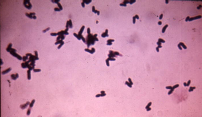 corynebacterium gram stain