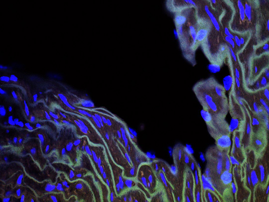 A confocal microscopy image of a wild-type aorta stained with human lamin A and lamin C-shown in green-Ang2-in red-and the nucleus-in blue. Image courtesy of Sahar Vakili.