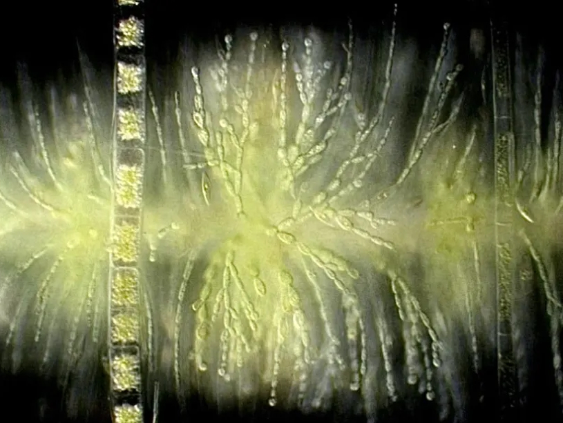 A microscopy image of batrachospermum, agenus of freshwater red algae commonly known as frog-spawn algae.