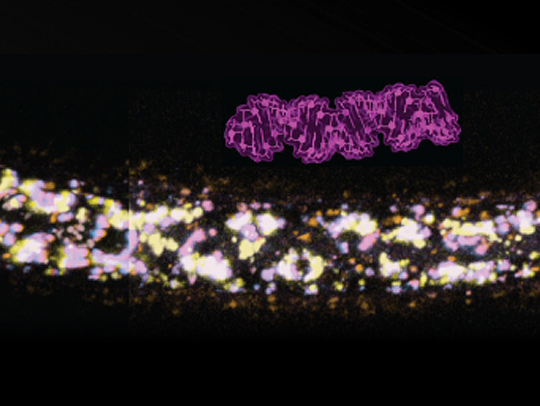 Microscopy image of  double-stranded RNA (magenta) and a roundworm.