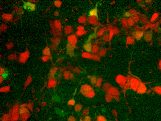 A fluorescence microscopy image readout measuring neural network activity. Credit: Network of optogenetically addressable neurons and astrocytes: Sylvester James Gates III and Kate M. O'Neill.