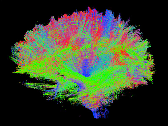 A colorful diffusion tensor imaging (DTI) scan of the brain. Image courtesy of the Jonathan Simon lab. A colorful diffusion tensor imaging (DTI) scan of the brain. Image courtesy of the Jonathan Simon lab.