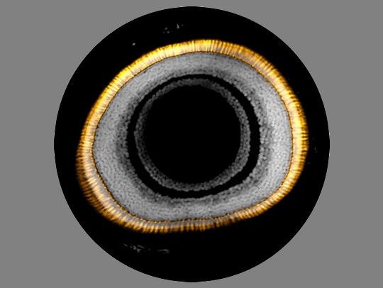 A closeup photo of a larval zebrafish eye highlights the nuclei of retinal cells (in gray) and PR1 cells (in yellow). ICredit: Juan Angueyra. A closeup photo of a larval zebrafish eye highlights the nuclei of retinal cells (in gray) and PR1 cells (in yellow). ICredit: Juan Angueyra.