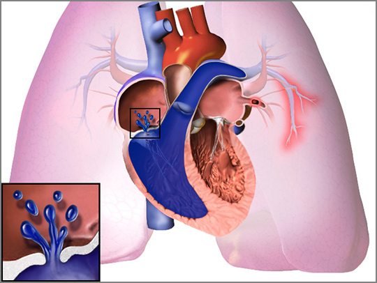 A medical illustration showing cutaway views ofthe heart and lungs. Credit: Wikimedia Commons.