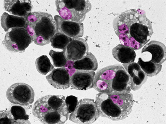 A microscopy image of leishmaniasis. Credit: Dave Mosser A microscopy image of leishmaniasis. Credit: Dave Mosser