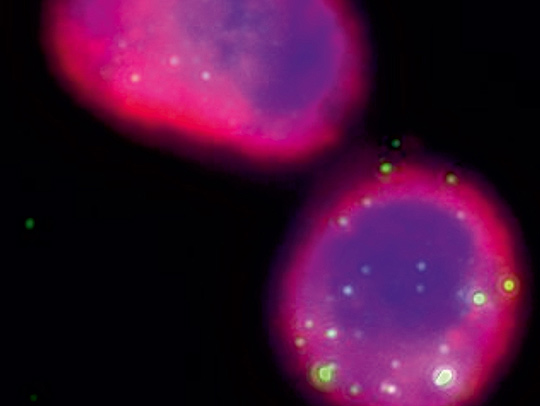 A fluorescence microscopy image of phages (small green lopsided circles) shown engulfed by much larger alveolar macrophages (cytoskeleton in pink and nucleus in blue). Image courtesy of Laurent Debarbieux and Solène Ecomard of the Institut Pasteur. A fluorescence microscopy image of phages (small green lopsided circles) shown engulfed by much larger alveolar macrophages (cytoskeleton in pink and nucleus in blue). Image courtesy of Laurent Debarbieux and Solène Ecomard of the Institut Pasteur.