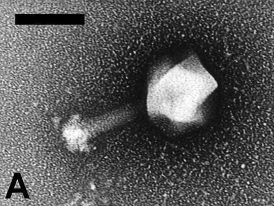 Electron microscopt image of the prochlorococcus myovirusvirus. Credit: MB Sullivan, et al., 2005, PLOS One, CC BY.