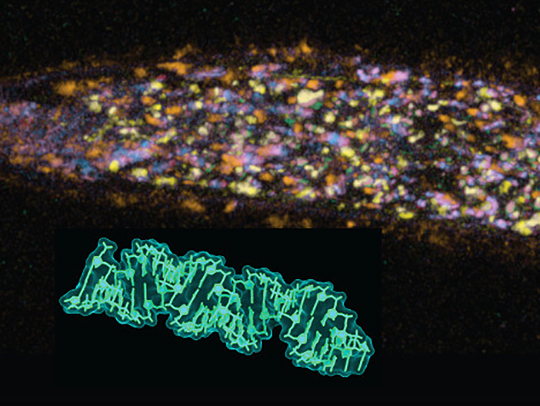 Crop of a microscopy image showing a form of double-stranded RNA that crosses cell membranes with the help of a conserved protein located in novel sites throughout a roundworm's body.